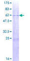 ST6GALNAC4 Protein - 12.5% SDS-PAGE of human ST6GALNAC4 stained with Coomassie Blue