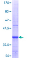 STARD4 Protein - 12.5% SDS-PAGE Stained with Coomassie Blue.