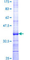 STARD5 Protein - 12.5% SDS-PAGE Stained with Coomassie Blue.