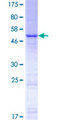 STARD6 Protein - 12.5% SDS-PAGE of human STARD6 stained with Coomassie Blue