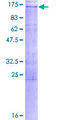 STARD8 Protein - 12.5% SDS-PAGE of human STARD8 stained with Coomassie Blue