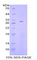 STAT4 Protein - Recombinant  Signal Transducer And Activator Of Transcription 4 By SDS-PAGE