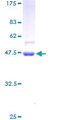 STK32A Protein - 12.5% SDS-PAGE of human STK32A stained with Coomassie Blue