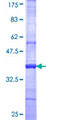 STK32A Protein - 12.5% SDS-PAGE Stained with Coomassie Blue.