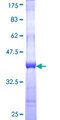 STKLD1 / SgK071 Protein - 12.5% SDS-PAGE Stained with Coomassie Blue