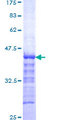 STON1-GTF2A1L Protein - 12.5% SDS-PAGE Stained with Coomassie Blue