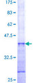 STX10 / Syntaxin 10 Protein - 12.5% SDS-PAGE Stained with Coomassie Blue.