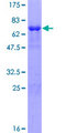 SUDS3 Protein - 12.5% SDS-PAGE of human SUDS3 stained with Coomassie Blue