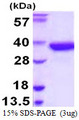 SULT1A2 / Sulfotransferase 1A2 Protein