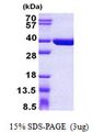 SULT1C4 / Sulfotransferase 1C4 Protein
