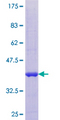 SUMO4 Protein - 12.5% SDS-PAGE of human SUMO4 stained with Coomassie Blue