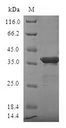 SUMO4 Protein - (Tris-Glycine gel) Discontinuous SDS-PAGE (reduced) with 5% enrichment gel and 15% separation gel.