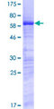 SURF2 / SURF-2 Protein - 12.5% SDS-PAGE of human SURF2 stained with Coomassie Blue