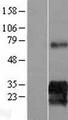 SUSD6 / KIAA0247 Protein - Western validation with an anti-DDK antibody * L: Control HEK293 lysate R: Over-expression lysate