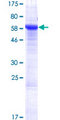 SUSD6 / KIAA0247 Protein - 12.5% SDS-PAGE of human KIAA0247 stained with Coomassie Blue