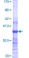 SVIL / Supervillin Protein - 12.5% SDS-PAGE Stained with Coomassie Blue.
