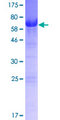 SYAP1 Protein - 12.5% SDS-PAGE of human SYAP1 stained with Coomassie Blue