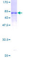 SYT12 / Synaptotagmin12 Protein - 12.5% SDS-PAGE of human SYT12 stained with Coomassie Blue