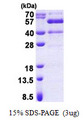SYT13 Protein