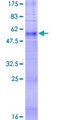 TAAR6 Protein - 12.5% SDS-PAGE of human TAAR6 stained with Coomassie Blue
