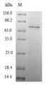 TAF11 Protein - (Tris-Glycine gel) Discontinuous SDS-PAGE (reduced) with 5% enrichment gel and 15% separation gel.