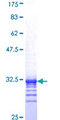TAF11 Protein - 12.5% SDS-PAGE Stained with Coomassie Blue.