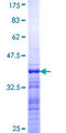 TAF2 Protein - 12.5% SDS-PAGE Stained with Coomassie Blue