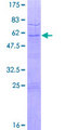 TAF9 Protein - 12.5% SDS-PAGE of human TAF9 stained with Coomassie Blue