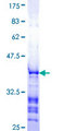 TAF9 Protein - 12.5% SDS-PAGE Stained with Coomassie Blue.
