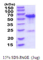 TBC1D22B Protein