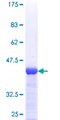TBCA Protein - 12.5% SDS-PAGE of human TBCA stained with Coomassie Blue