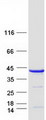 TBCC Protein - Purified recombinant protein TBCC was analyzed by SDS-PAGE gel and Coomassie Blue Staining