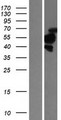 TBRG1 Protein - Western validation with an anti-DDK antibody * L: Control HEK293 lysate R: Over-expression lysate