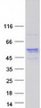TCAIM Protein - Purified recombinant protein TCAIM was analyzed by SDS-PAGE gel and Coomassie Blue Staining
