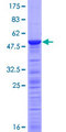 TCEANC2 Protein - 12.5% SDS-PAGE of human C1orf83 stained with Coomassie Blue