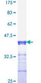 TCF7L2 / TCG4 Protein - 12.5% SDS-PAGE Stained with Coomassie Blue.