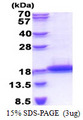 TCL1B Protein