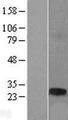 TCP10L Protein - Western validation with an anti-DDK antibody * L: Control HEK293 lysate R: Over-expression lysate
