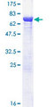 TCP11 Protein - 12.5% SDS-PAGE of human TCP11 stained with Coomassie Blue