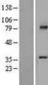 TCTN2 Protein - Western validation with an anti-DDK antibody * L: Control HEK293 lysate R: Over-expression lysate
