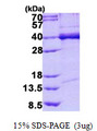 TDP-43 / TARDBP Protein