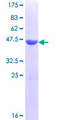 TEX14 Protein - 12.5% SDS-PAGE Stained with Coomassie Blue.