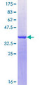 TEX15 Protein - 12.5% SDS-PAGE Stained with Coomassie Blue.