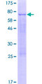 TFAP2E Protein - 12.5% SDS-PAGE of human TFAP2E stained with Coomassie Blue