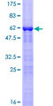 TGIF2LX Protein - 12.5% SDS-PAGE of human TGIF2LX stained with Coomassie Blue