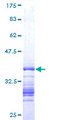 TGIF2LX Protein - 12.5% SDS-PAGE Stained with Coomassie Blue.