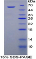 TGM1 / Transglutaminase Protein - Recombinant Transglutaminase 1, Keratinocyte By SDS-PAGE