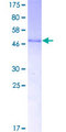 THAP1 Protein - 12.5% SDS-PAGE of human THAP1 stained with Coomassie Blue