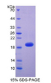 THBD / CD141 / Thrombomodulin Protein - Recombinant Thrombomodulin By SDS-PAGE