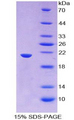 THOP1 / Thimet Oligopeptidase Protein - Recombinant Thimet Oligopeptidase 1 By SDS-PAGE